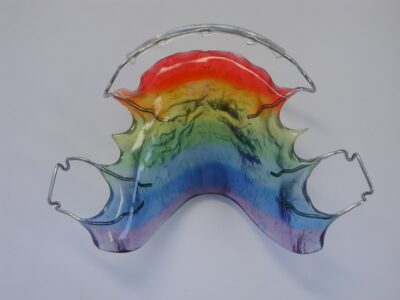 Aparato de ortopedia bucal para corregir dientes apiñados y torcidos en niños