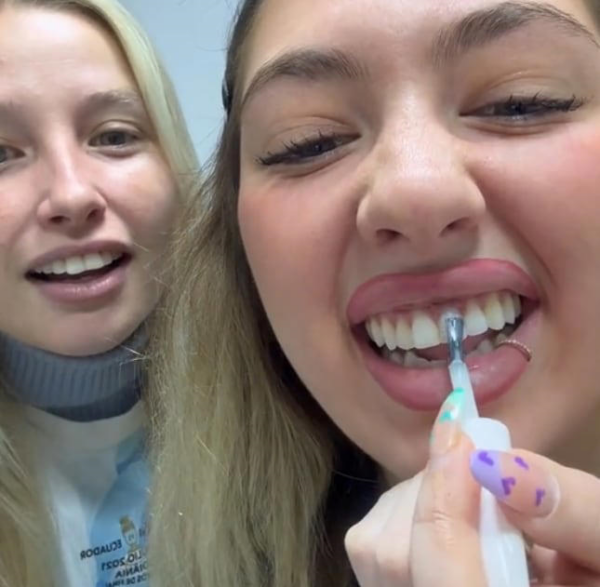 Tendencia en Tiktok que nunca debes seguir: blanquear tus dientes con esmalte de uñas