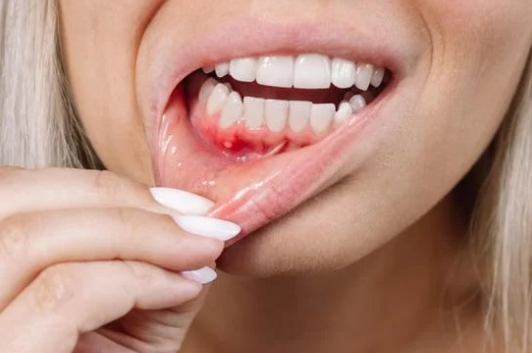 La enfermedad de las encías pueden afectar a tu corazón, e incluso que pierdas dientes.